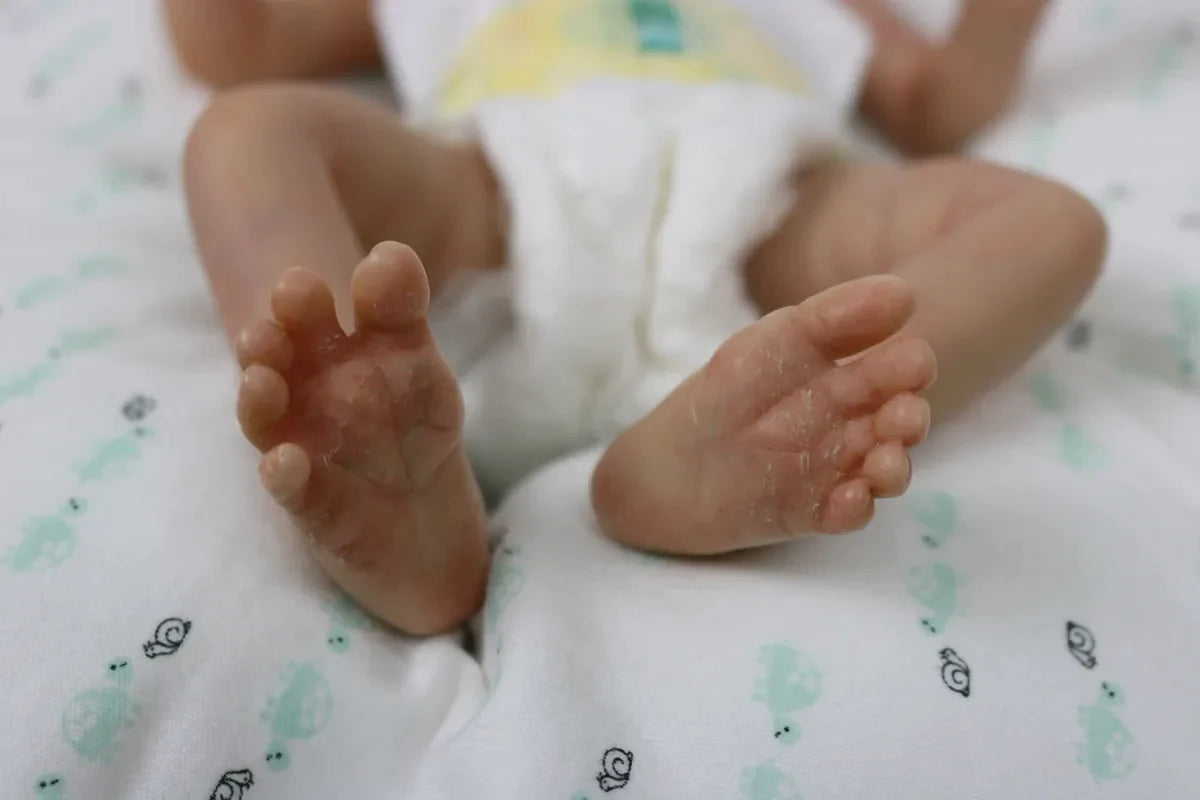 Preemie Baby Lou